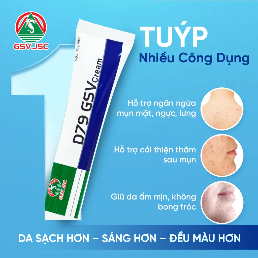 Kem Dưỡng D79 GSV Cream Hỗ Trợ Ngăn Ngừa Mụn Mờ Thâm Kiểm Soát Dầu Nhờn Cho Mặt Ngực Lưng 15g 2