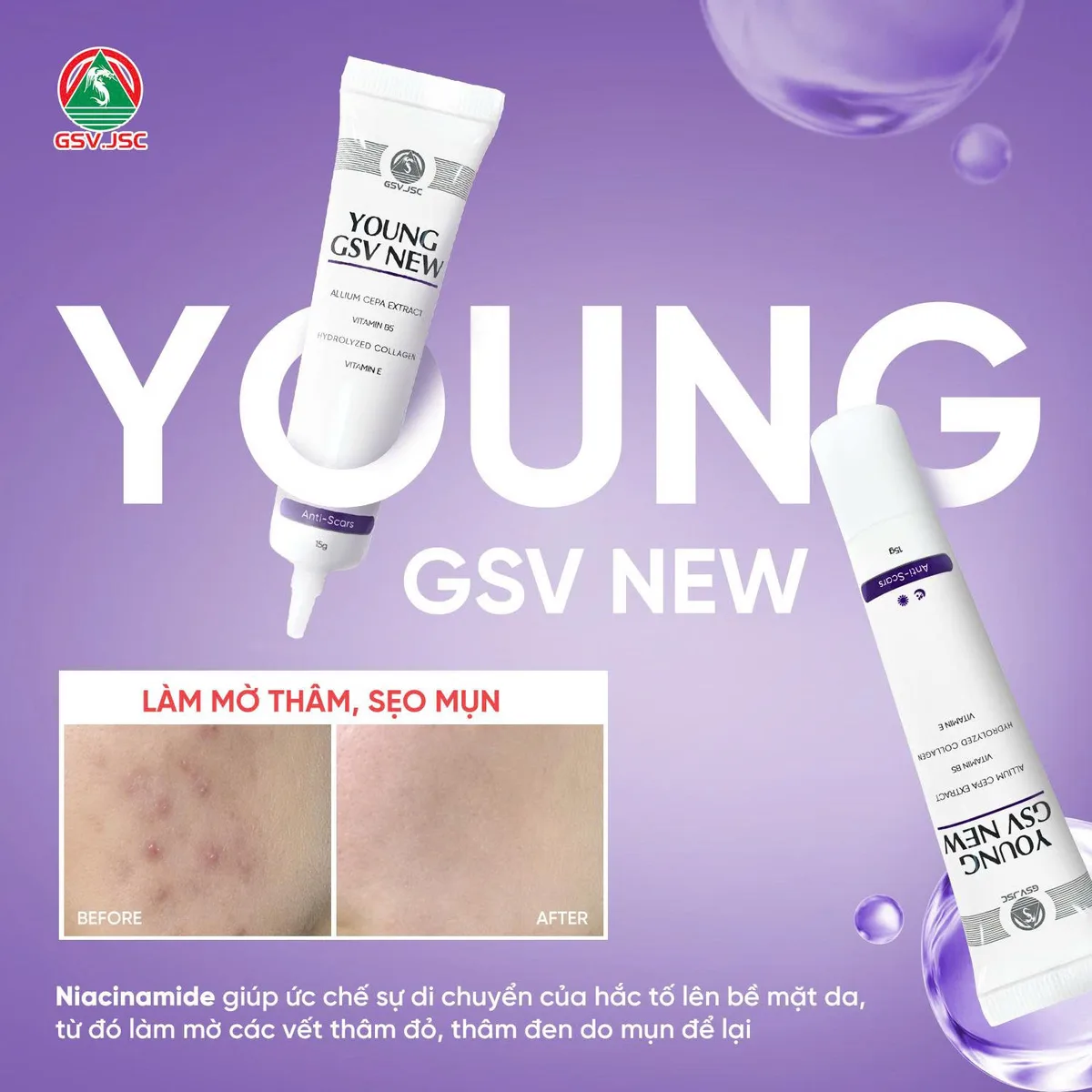 Gel Làm Mờ Sẹo Young GSV New Hỗ Trợ Giảm Thâm Mụn Sạm Nám Tái Tạo Da Với Allium Cepa Và Collagen 15g 6