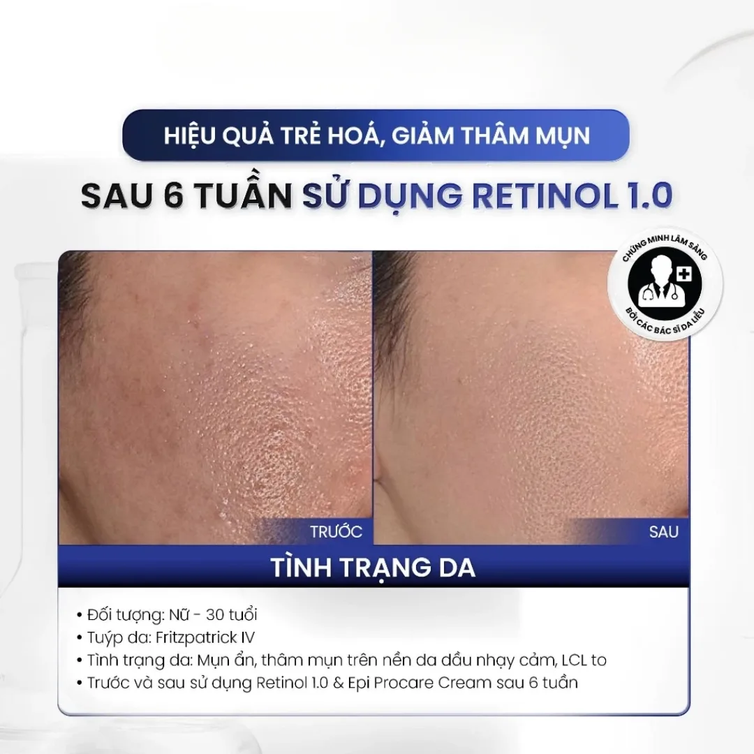 Kem Dưỡng Đêm MD Care Pro Retinol Hỗ Trợ Làm Sáng Da Cải Thiện Nếp Nhăn Và Dấu Hiệu Lão Hóa 30ml 12