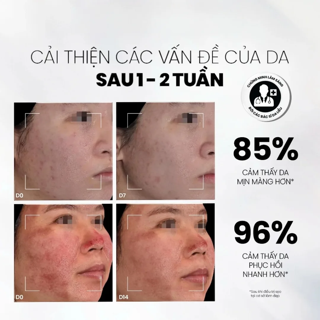 Tinh Chất Phục Hồi MD CARE Copper Peptide Serum Hỗ Trợ Tăng Sinh Collagen Làm Đầy Sẹo Chống Lão Hóa 30ml 6