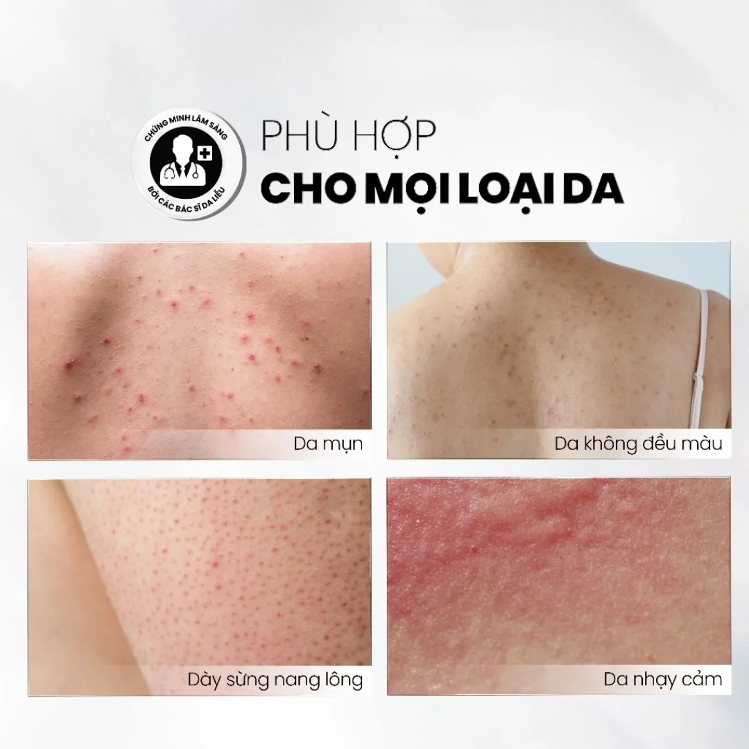 Xịt Tẩy Tế Bào Chết Toàn Thân MD Care Exfoliating Body Spray AHAs BHA Hỗ Trợ Giảm Mụn Lưng Ngực 100ml 5