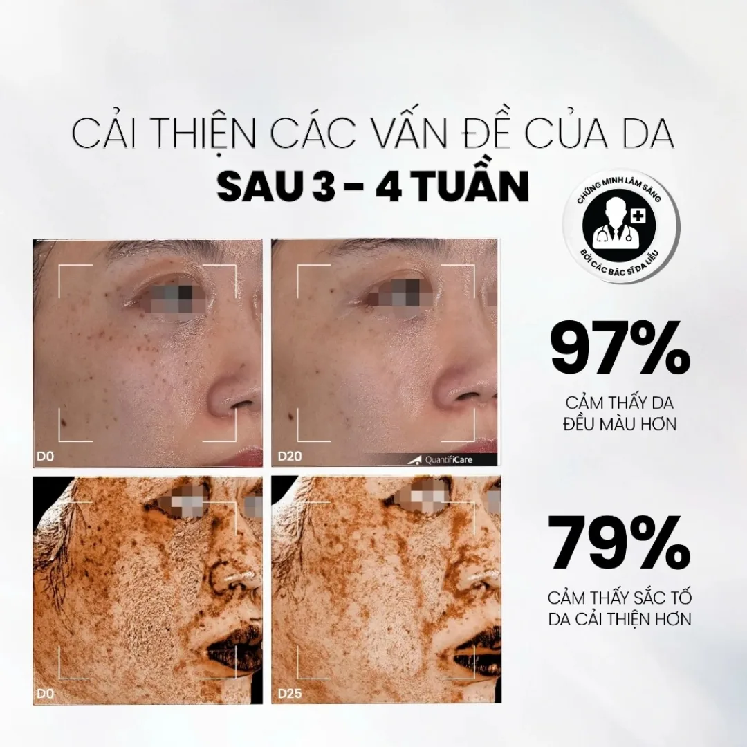 Serum MD Care VitaC Arbutin Whitening Advanced Formula Hỗ Trợ Làm Sáng Da Mờ Thâm Chống Lão Hóa 30ml 5