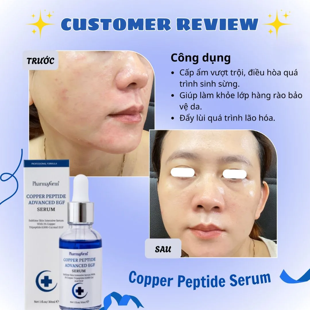 Tinh Chất Pharmaform Copper Peptide Advanced EGF Phục Hồi Da Tổn Thương Hỗ Trợ Chống Lão Hóa 30ml 3