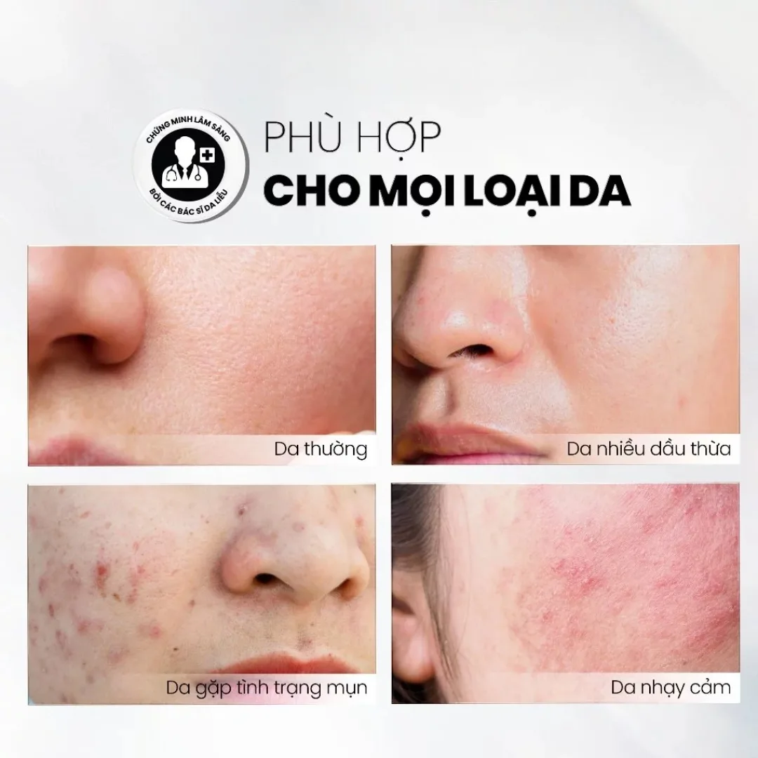 Sữa Rửa Mặt MD CARE Mandelic Acid 5% Dạng Gel Làm Sạch Sâu Tẩy Tế Bào Chết Nhẹ Nhàng Cho Da Dầu Mụn 30ml/200ml 4